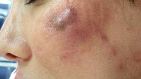 Thảm họa thẩm mỹ tự mua và làm tại nhà