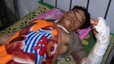 Nhân chứng kể lại vụ lật xe thảm khốc