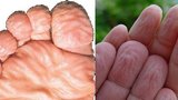 Vì sao ngón tay nhăn nheo khi ngâm nước?