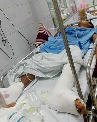 bệnh viện Việt Đức, mổ nhầm chân