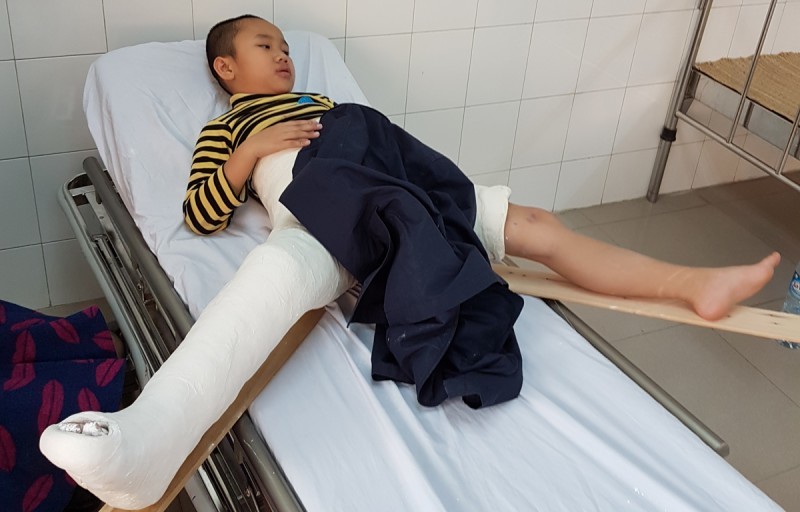 Vụ tai nạn Nam Trung Yên: Học sinh bị thương tật 32% - Ảnh 1.