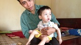 Bệnh tim bẩm sinh, bé 2 tuổi mà không biết đứng