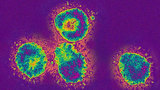 Pháp: Thêm hai ca nghi bị nhiễm virus giống SARS