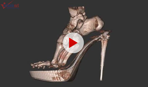 Khoa học tuần qua: Cô gái muốn sex với 100.000 đàn ông