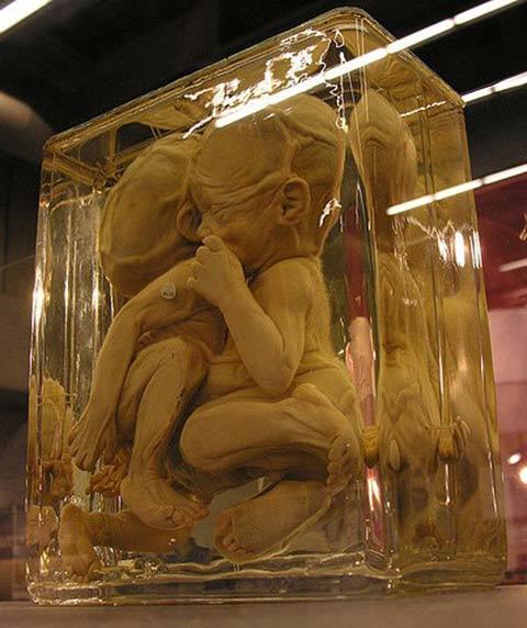 bảo tàng, đột biến y khoa