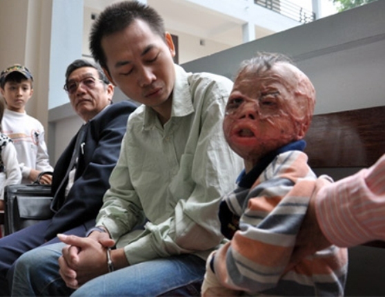 cháu bé, nghẹn lòng, độc ác