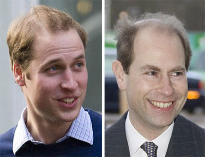 Hoàng tử Anh được mời quảng cáo thuốc mọc tóc