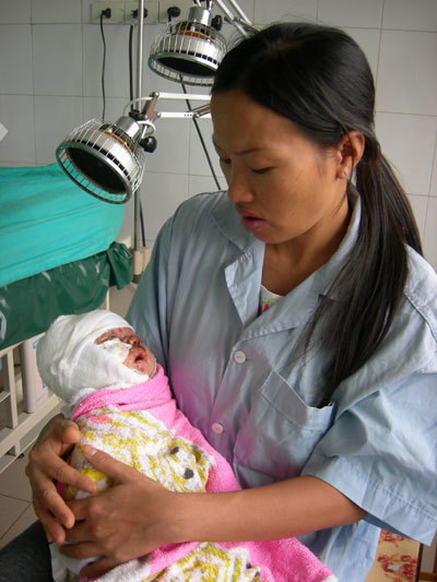 Sưởi ấm, bé 1 tháng tuổi rơi vào chậu than
