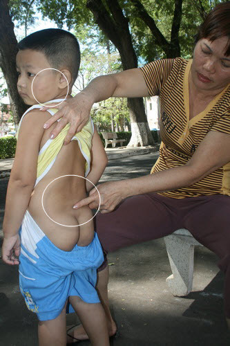 Bé 3 tuổi bị bắt cóc, đánh đập dã man