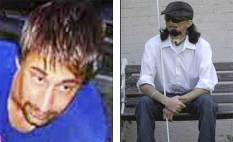 Ước mơ của người đàn ông cấy ghép mặt