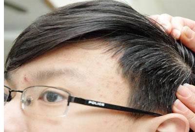 Cách gì chữa tóc bạc sớm?