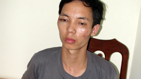 Bắt gọn tên cướp vơ vàng bỏ vào túi giữa ban ngày