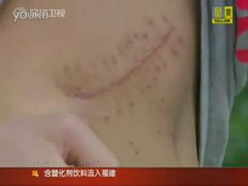 Cậu bé bán thận lấy tiền mua iPad 2