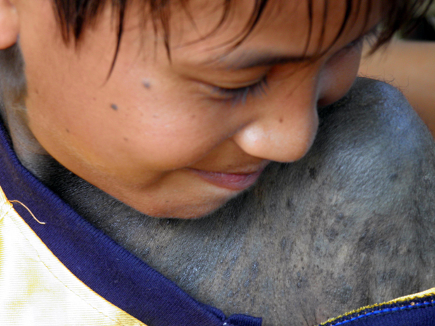 Cậu bé mọc lông như 'người rừng' ở Quảng Bình