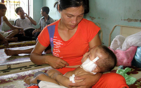 Bé 10 tháng tuổi bị bò húc đang nguy kịch