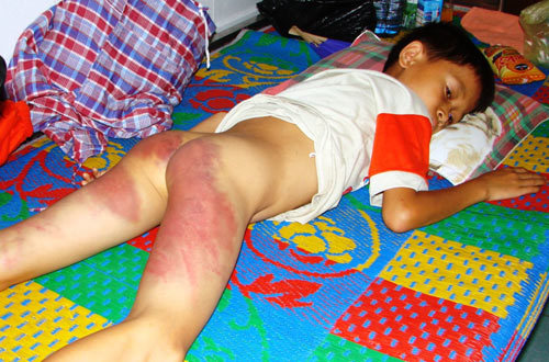 Đình chỉ 1 cảnh sát trong vụ HS nhập viện