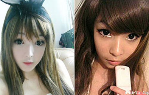 Mốt kéo chân, bóp dáng, chỉnh mũi của giới trẻ