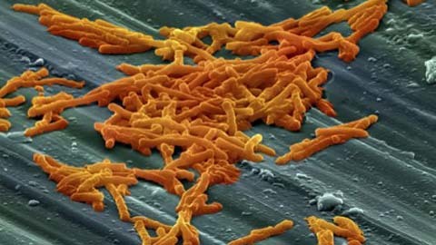 Dịch tiêu chảy bùng phát tại Canada, 16 người thiệt mạng