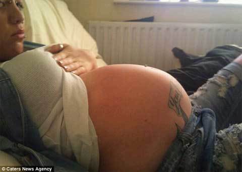 Kỳ lạ thiếu nữ bụng phồng xẹp như bóng