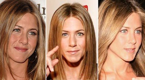Điểm mặt sao đẹp gấp bội nhờ phẫu thuật