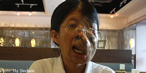 Nghị lực phi thường của 