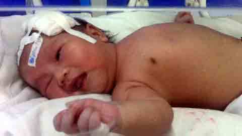 Cứu sống 2 trẻ nhỏ bị chấn thương sọ não