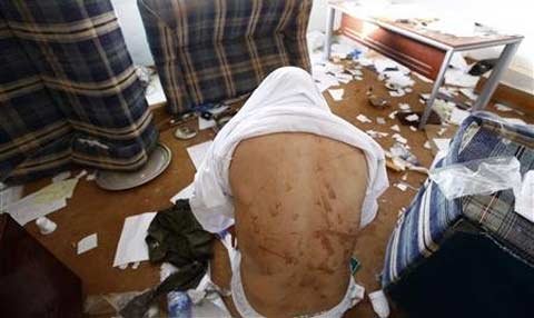 Lật tẩy đội tra tấn khủng khiếp của Gaddafi