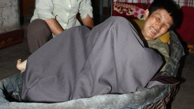 Cô gái sống trong giỏ mây suốt 16 năm