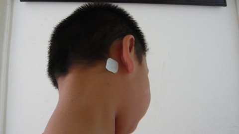 Dán thuốc chống say xe, bé gái bị ảo giác