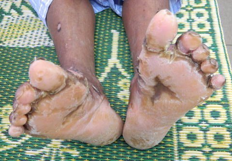 Truy tìm nguyên nhân 'bệnh lạ' làm dân lo lắng