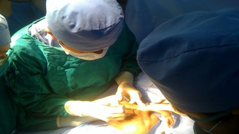 Nhiều nỗi lo của bà mẹ có con 4 tay