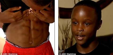 Cậu bé bụng 8 múi thành thần tượng của giới trẻ Mỹ