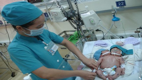 Đã tiến hành hội chẩn cho em bé 2 đầu