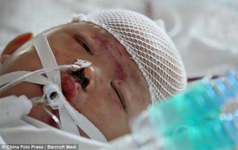 Trung Quốc bắt 2 lái xe chẹt lên người bé 2 tuổi