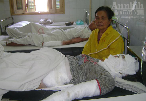 Dùng bếp gas, sơ sẩy là... bùm