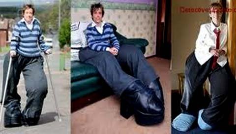 Kỳ lạ đôi chân khổng lồ cắt lại mọc nhanh