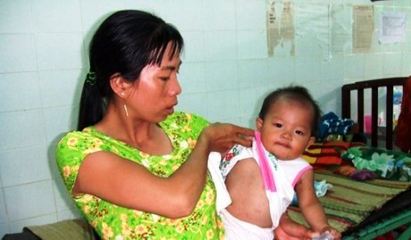 Đã có địa phương công bố dịch tay chân miệng