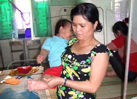 'Vì Bộ Y tế, đề nghị TS Khải thông cảm!'