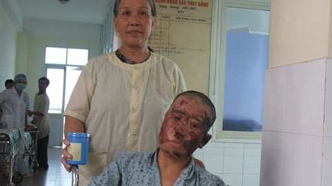 Không có đôi mắt, cô Hồng chỉ còn cách 