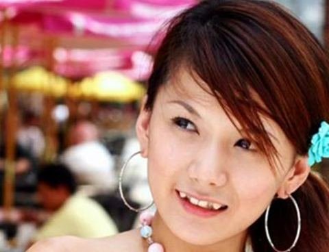 Vì sao phụ nữ Nhật thích làm răng khểnh?