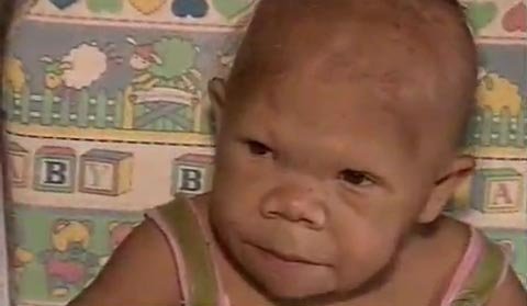 Thiếu nữ 30 như bé 9 tháng tuổi