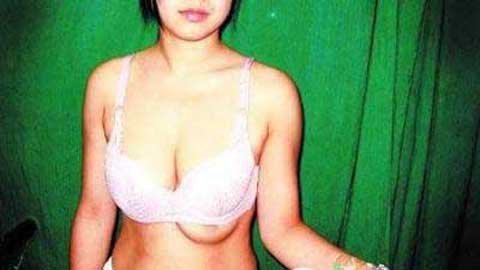 Nỗi khổ của cô gái có 3 gò bồng đảo