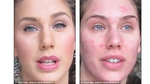 Thiếu nữ mặt mụn hóa tiên gây sốt YouTube