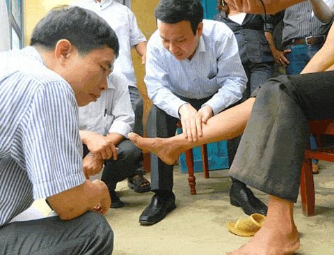 18 người nhập viện vì 'bệnh lạ'