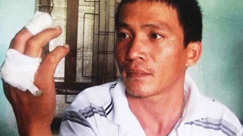 Hy hữu ở VN: Thuốc lá phát nổ
