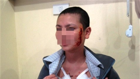 Cuộc đời u tối của cô gái bị xăm rết