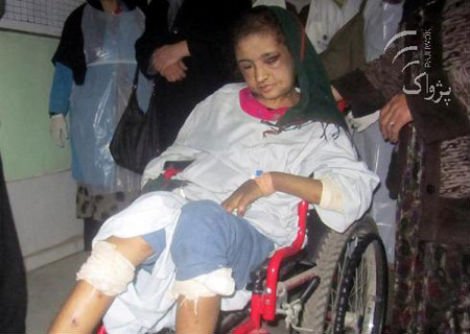 Bị mẹ chồng nhốt  5 tháng trong toilet vì không bán dâm