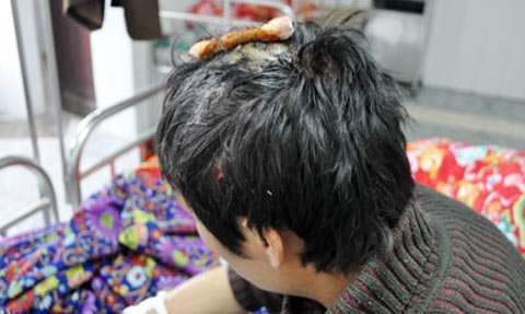 Đang ngủ, 7 công nhân bị chém nhập viện