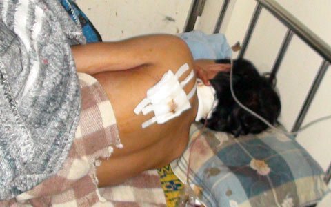 Đôi vợ chồng sắp cưới bị chém dã man đêm giao thừa