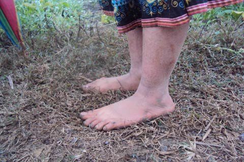 Lạnh cóng những đôi chân trần trong sương giá